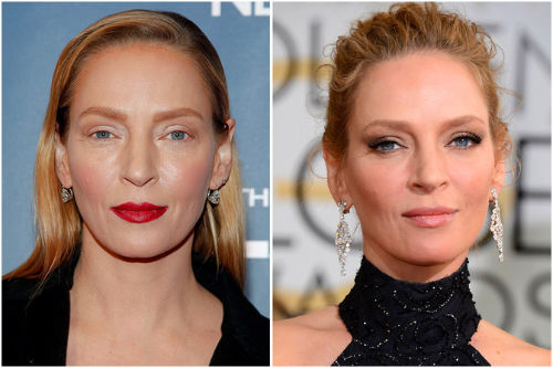 Ума Турман гоо сайхны мэс засал хийлгэсэн үү?