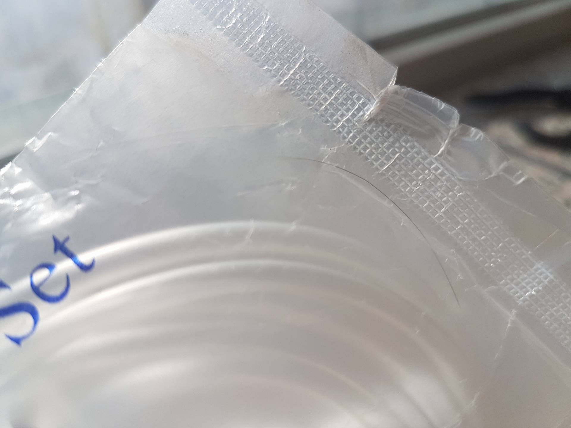 “Их төгөл” эм ханган нийлүүлэх байгууллагын импортлодог дуслын систем дотор үс байжээ