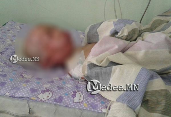 Савтай бензин дэлбэрч гэр бүлийн таван хүн түлэгджээ