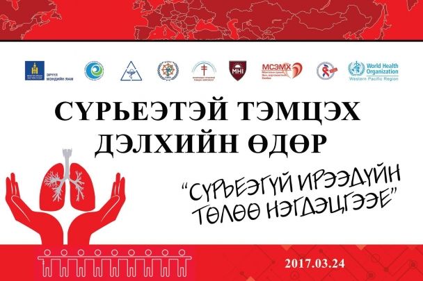 Улсын хэмжээнд жилд 4000 гаруй сүрьеэгийн шинэ тохиолдолд бүртгэгдэж байна