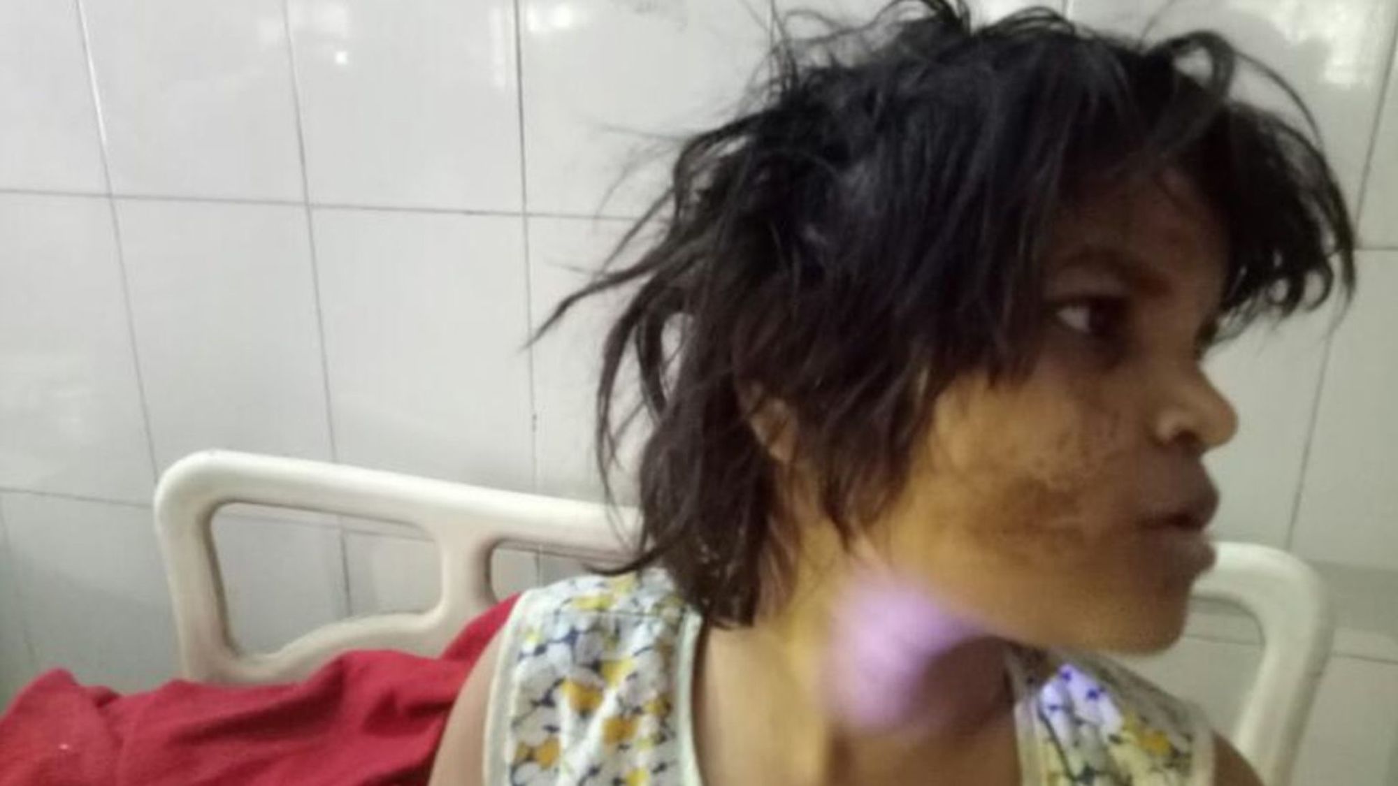 Энэтхэгт Маугли охин олджээ