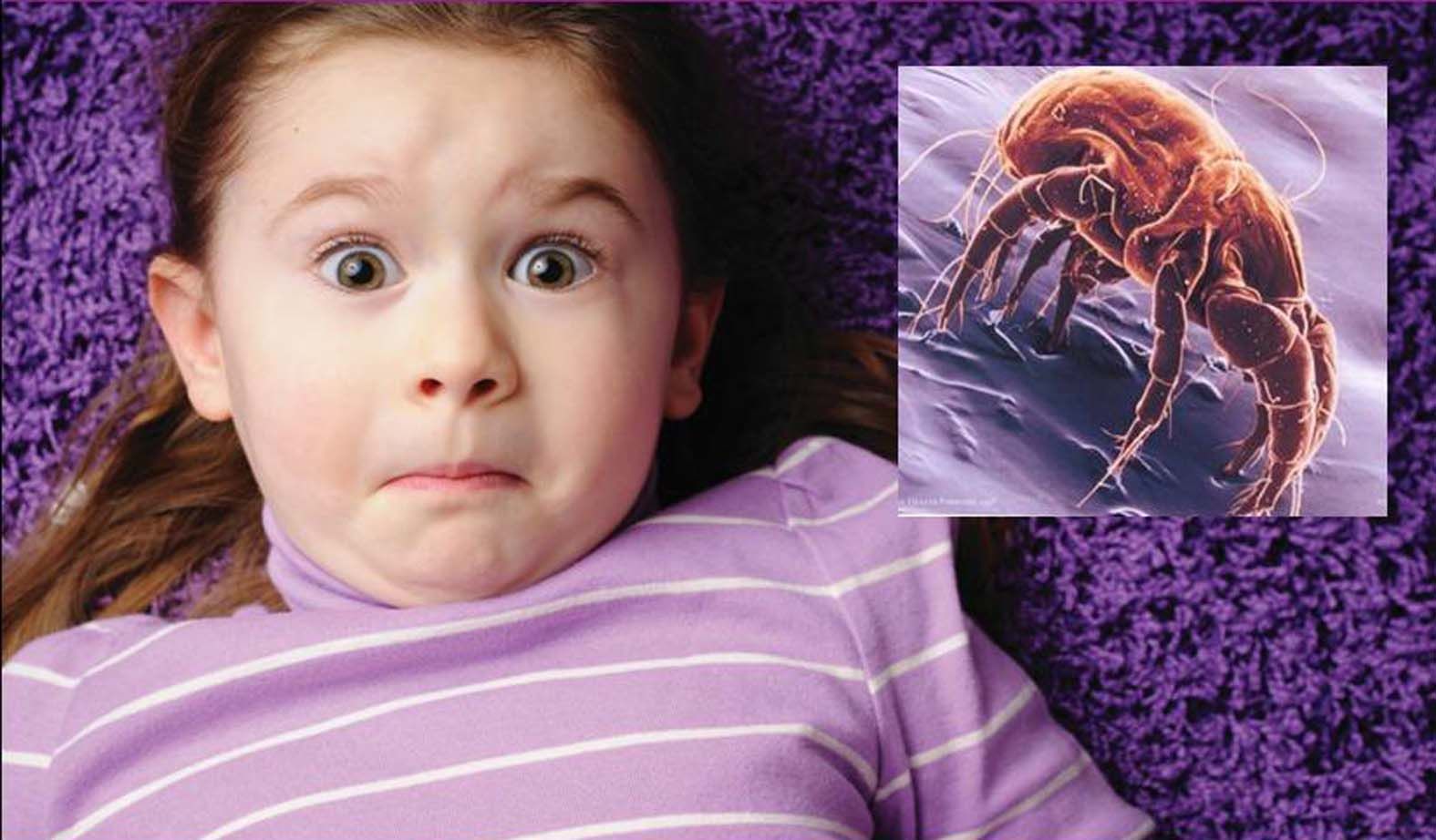 Гэрийн тоосны хачиг нь бага насны хүүхдийг харшилтай болгодог