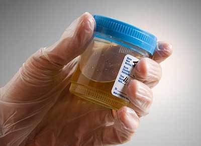 Та шинжилгээ өгөх гэж байна уу? 