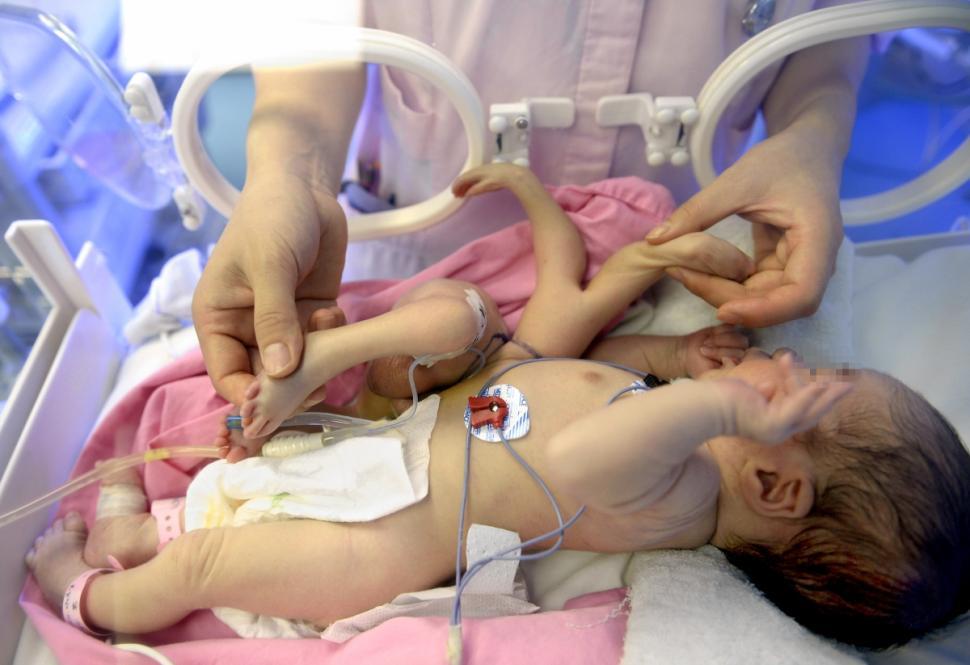 Дөрвөн гар, дөрвөн хөлтэй хүүхэд төржээ