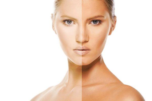 Наранд борлож, түлэгдсэн арьсыг цайруулж эмчлэх 7 арга